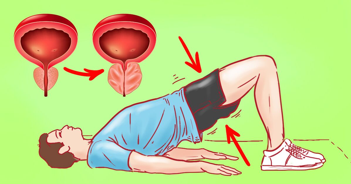 gymnastic exercises para sa prostatitis