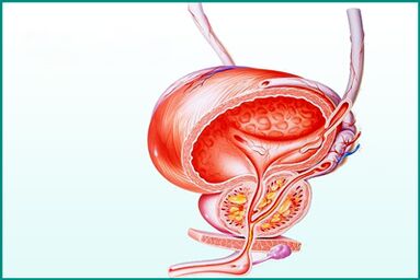 Ang pamamaga ng prostate sa talamak na prostatitis ay isang limitasyon para sa pakikipagtalik